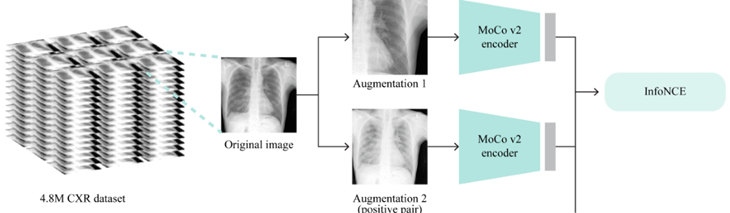 https://link.springer.com/article/10.1007/s10278-023-00782-4